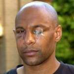 ousmane dabo na het gevecht met Barton